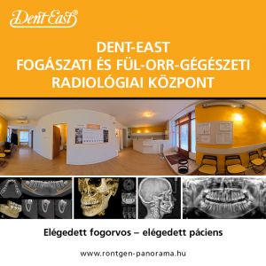 CBCT felvételek